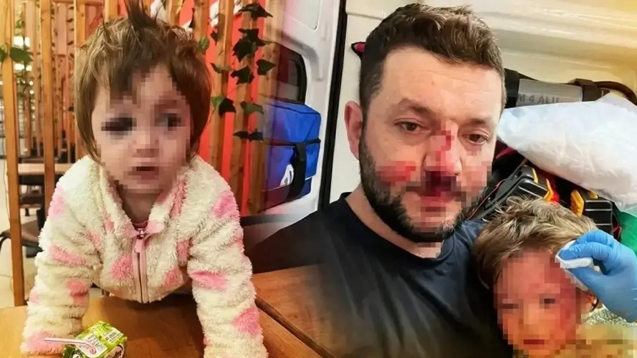 Baba ve 14 Aylık Bebeğin Darbedildiği Olayda Tutuklu Komşunun Kan Donduran İfadesi: 'Çocuğu Fark Etmedim'