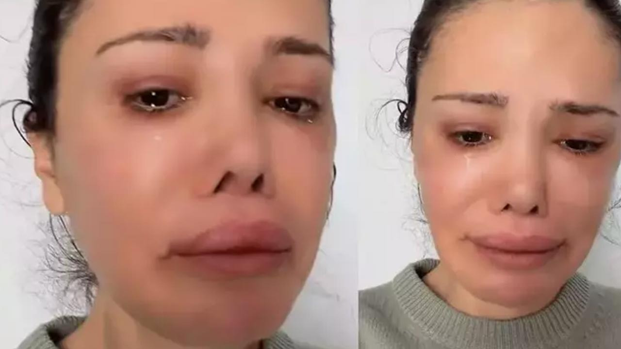 Yüz Nakli Yaptırmıştı, Didem Ceran Hastalığını Ağlayarak Açıkladı