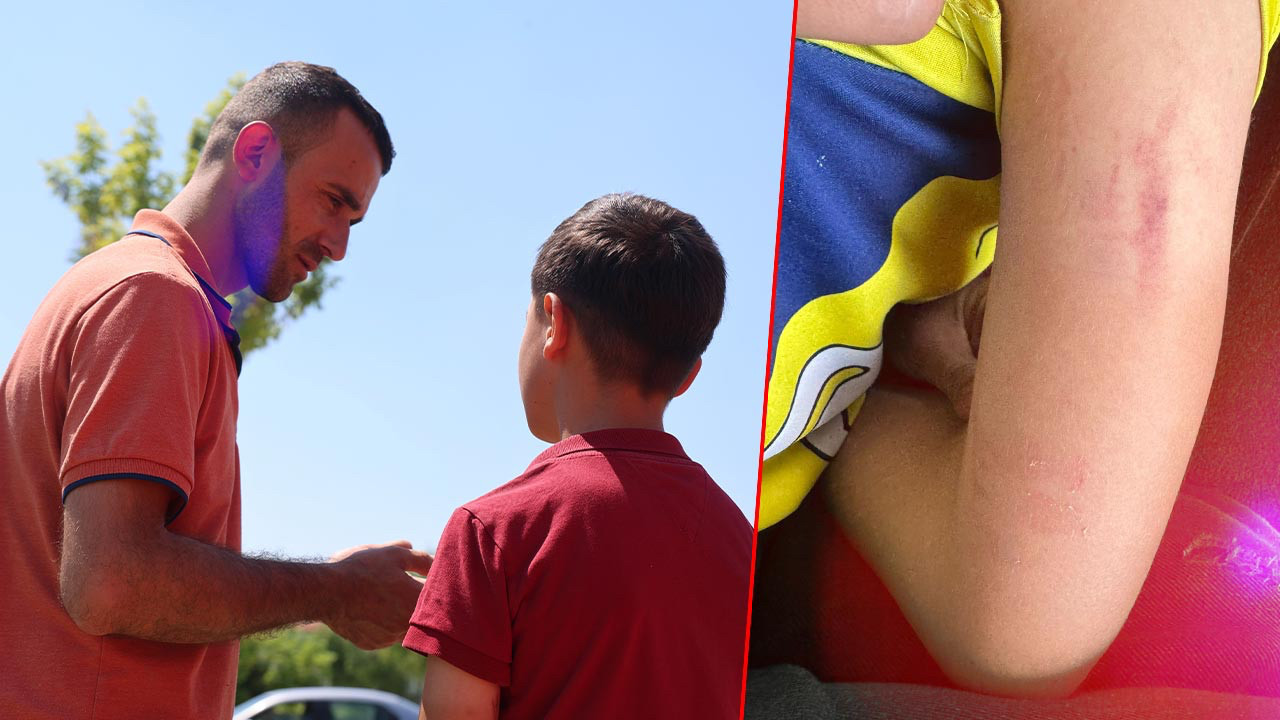 Konya'da Okul Çıkışında Skandal! Anne 10 Yaşındaki Çocuğu Darp Etti