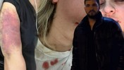 Esenyurt'ta Erkek Dehşeti: Kapıyı Kırıp Dakikalarca Darbetti, Serbest Kaldı