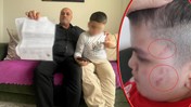 Otizmli Çocuğa 'Okulda Şiddet' İddiası: Vücudunda Tam 54 Morluk Tespit Edildi, Savcılık Harekete Geçti