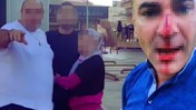 Trafik Kazası Kavgaya Dönüştü: Eşi ve Çocuklarının Önünde Darbedildi!