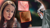 Ünlü Deodorant Markasında Skandal! Bir Kez Kullananın Bile Derisi Yandı! Şikayet Yağdı