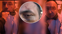 Sevgiliden Korkunç Tuzak, Saniyeler İçinde Dehşeti Yaşadı