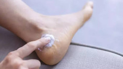 Ayak Kokusunu, Mantarı, Nasırı 5 Dakikada Geçiriyor: Haftada 2 Kez Sürünce Egzamanın Kökünü Kazıyor