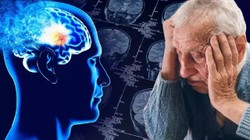 Belirti Yokken Bile Sonuç Veriyor! Bu Kan Testi Alzheimer Riskini Gösteriyor