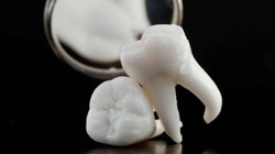 Elinde 20'lik Dişleri Olanlar Yaşadı! Servet Değerinde