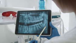 Uzmanından 'İmplant' Uyarısı! 'Sakın Bunları Yapmayın'