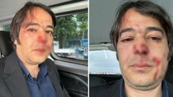İBB İmar ve Şehircilik Daire Başkanı'nın Tutukluluğuna İtiraz Edilecek