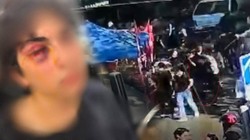 15 Yaşındaki Çocuk Öldüresiye Darbedilmişti... CHP Standındaki Saldırıda Yeni Gelişme