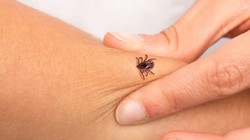 Yaz Mevsimiyle Birlikte Kene Tehlikesi Yeniden Gündeme Geldi: Nelere Dikkat Edilmeli?