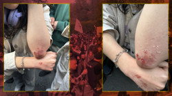 Boğaziçi Üniversitesi'ndeki 'Nureddin Yıldız' Protestolarında Gözaltına Alındı, Şiddete Uğradı! Darp Raporuna Polis mi El Koydu?