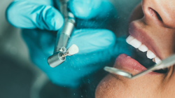 Eksik Dişi Olanlar Dikkat! Ağızdaki Sessiz Tehlike… Bir Değil İki Hastalığı Beraberinde Getiriyor