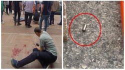 Antalya’da Silahlı ve Sopalı Kavga: 4 Yaralı, 3 Gözaltı