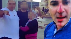 Trafik Kazası Kavgaya Dönüştü: Eşi ve Çocuklarının Önünde Darbedildi!