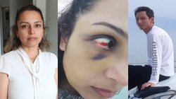 Hamileliği Boyunca Şiddet Gördü... Burcu Öğretmenin Acı Çığlığı! 'Bu Adamdan Kurtulamıyorum, Yardım Edin'