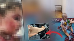 1,5 Yaşındaki Bebeğe Dehşette Ödül Gibi Ceza Talebi! Anne Yalanladı Bakıcı İtiraf Etti