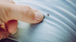 Keneler En Çok Nerelere Tutunur? Eve Geldiğinizde Bu Bölgeleri Mutlaka Kontrol Edin