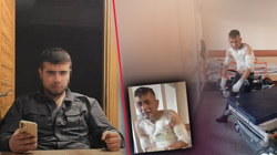 Saldırı Değil İşkence! Engelli Vatandaşı Benzinle Yaktı… Her Saniyesi Kan Dondurdu