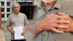 Taburcu Oldu, 3 Dakika Sonra Kalbi Durdu! Yoğun Bakımda Vicdansız Pazarlık