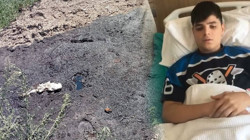 Fabrika İhmali Çocuğu Ayağından Ediyordu! Asit Çamuruna Bastı, Su Diye Döktüğü Sıvı da Asit Çıktı