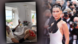 Podyumların Yıldızı Ünlü Model Bella Hadid Yeniden Hastanelik Oldu! 15 Yıllık Acı, 100’den Fazla Tedavi