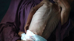 Gazze 'Açlıktan' Ölüyor! Son 24 Saatte 5 Can Kaybı Daha