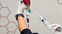 Ozon Tedavisi İçin Önemli Uyarı, Artırıyor