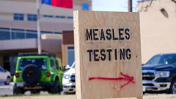 ABD’de Kızamık Alarmı! Uzmanlardan Korkutan Uyarı