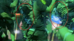 Billie Eilish Konserinde Korkutan Anlar! Hayranı Öyle Bir Çekti ki...