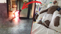 Dehşete Düşüren Görüntüler! '16 Yaşındaki Çocuk, 15 Yaşındaki Arkadaşını Benzinle Yaktı' İddiası