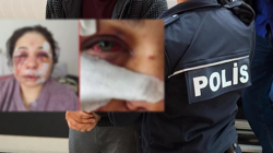 Eşini Ağır Şekilde Darp Eden Polis Tutuklandı! Bakanlardan Peş Peşe Açıklamalar