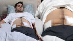 İstanbul'un Göbeğinde Dehşet! Saldırıya Uğrayan Çocuğa Yardım Etmek İstedi, 6 Yerinden Bıçaklandı