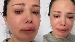 Yüz Nakli Yaptırmıştı, Didem Ceran Hastalığını Ağlayarak Açıkladı