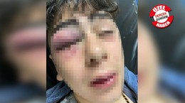 Çocuğa işkencede polislerin bırakılma gerekçesi şaşırttı... Mahkeme: Polisler Urfalı, Kürtlere küfrettirmeleri olağan hayata aykırı