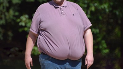 Dünyanın en obez ülkeleri açıklandı
