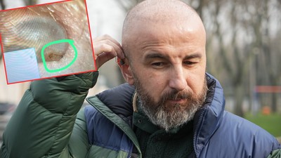 Estetik Merkezinde Skandal: Saç Hayali İçin Gitti, Kulak Zarı Biçildi