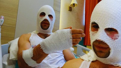 Nişanlısına Hediye Hazırlarken Dehşeti Yaşadı: Sprey Boya Bomba Gibi Patladı