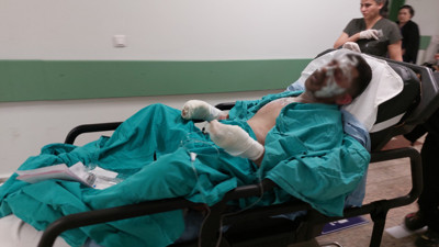 Yaktığı Ateşe Döktüğü Tiner Az Daha Canından Ediyordu