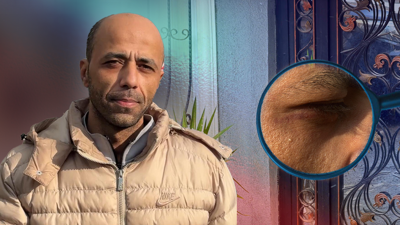 Dehşet Otelinde 2 Gün! Darp, Tehdit, İşkence… Tek Mesajla Ölümden Döndü