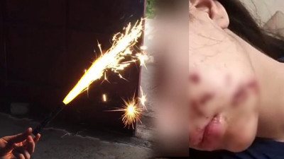 Bayram Günü Maytap Faciası! Genç Kız Kabusu Yaşadı