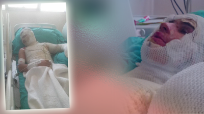 Adana’da Korkunç ‘Amca’ Dehşeti! 16 Yaşındaki Yeğenini Yaktı, O da Yetmedi Suçu Ağabeyinin Üstüne Attı