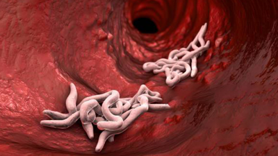 Vücuda Acısız Şekilde Nüfuz Ediyor, Gizli Gizli Kansere Götürüyor! Avrupa'da Görülmeye Başladı