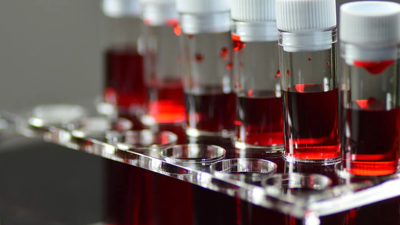 Dünyada Sadece Bir Kişide Görülen Yeni Kan Grubu Keşfedildi