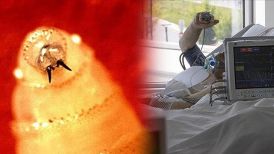 Vida Kurdu Sineği Alarm Durumuna Geçirdi! Vücudu Canlı Canlı Yiyor