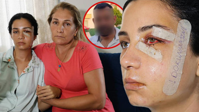 Sedef'in Yaşam Çığlığı: Ölümden Mesaj Atarak Kurtuldu! 'Yaşarken Kurtulayım, Öldükten Sonra Değil'