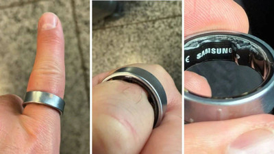 Akıllı Yüzük Parmağındayken Şişti! Ünlü YouTuber Hastanelik Oldu: Dev Markadan Açıklama