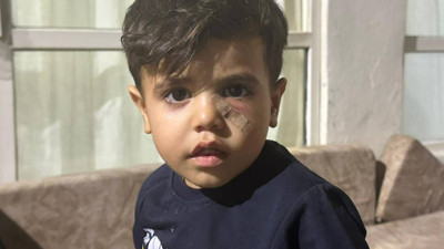 Yorgun Mermi Kör Ediyordu! 4 Yaşındaki Ömer Faruk Faciadan Döndü