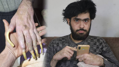 Hayatla Bağını Kopardı... Banyo Yapmıyor, Tırnaklarını Kesmiyor: 'Hayalim Yok, Evde Oturacağım'