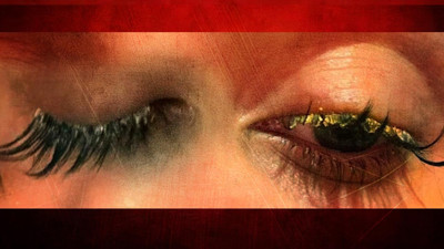 Güzellik Merkezinde Dehşet! Kirpiklerini Yaptırmaya Gitti Kimyasal Gözünü Yaktı